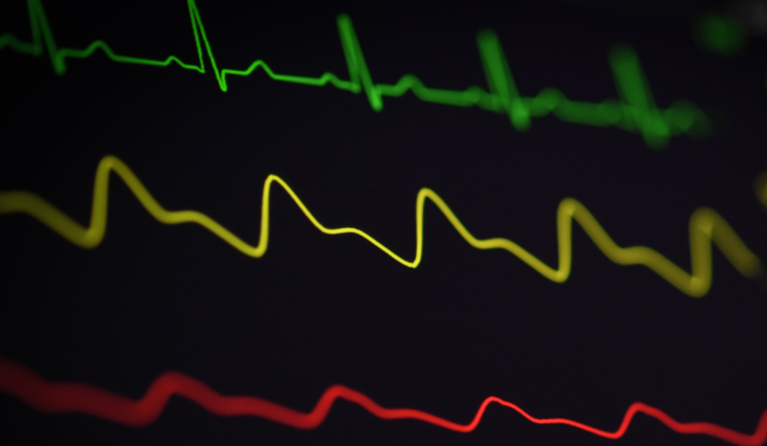 WHAT IS HEART RATE VARIABILITY AND WHY DOES IT MATTER?